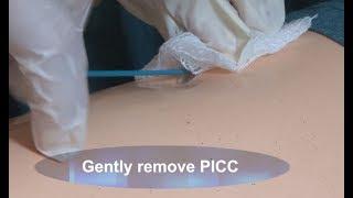 How to Remove a PICC Demo