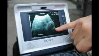 San Diego Zoo vet explaining panda ultrasound