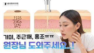 색소 더 올라와요! 기미, 주근깨, 홍조 다 같은 색소가 아니다! 내 피부 상태에 맞는 치료 방법