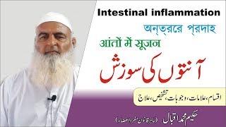 Intestinal Inflammation || آنتوں کی سوزش || आंतों में सूजन || অন্ত্রের প্রদাহ || Al Huda Guidance