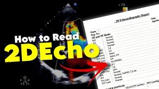 2DEcho || How to READ 2DEcho report || Echocardiography • Daily Cardiology