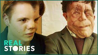 The Ugly Face of Disability Hate Crime (Adam Pearson Documentary) | Real Stories