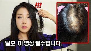 ENG) 머리가 빠진다면 이 영상 꼭 보세요  탈모 극복하는법 완결판 How to overcome hair loss- the complete guide | 뷰티클라우드 유나 UNA