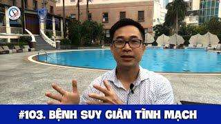 #103. Bệnh suy giãn tĩnh mạch