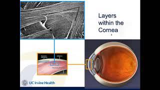Crosslinking – It’s Finally Here! | Webinar 2016