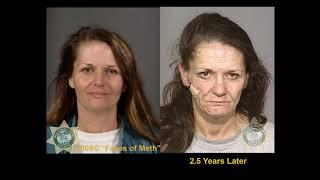 Street Drugs - Faces of Meth (Disturbing Depictions of Drugs)