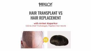 Hair Transplant vs Hair Replacement / Hair Patch for Men | What is Right for You?