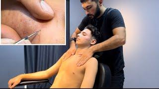 ASMR Skin Care Blackhead Cleaning And Body Massage ADD-FREE