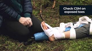 Upper Leg Splint - Fundamentals of Wilderness First Aid