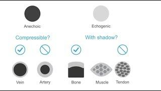 Distinguishing nerves from surrounding structures