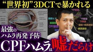 【世界初】3DCTで証明されたCPFハムラの再発。表ハムラ・裏ハムラ”最強？”の再発予防CPFハムラの嘘【クマ取り/クマ治療】