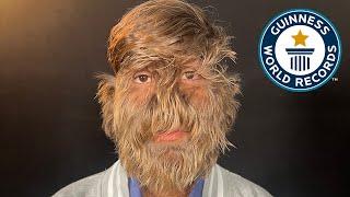 Hairiest Face - Guinness World Records