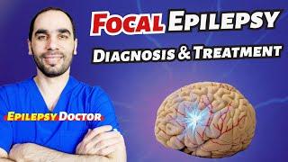 Focal or Partial Epilepsy: Diagnosis and Treatment