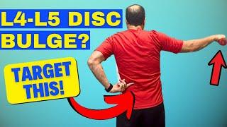 3 KEY L4-L5 Disc Bulge Exercises Most People Don’t Know | Dr. Walter Salubro Chiropractor in Vaughan