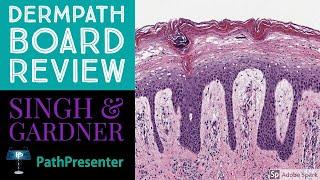 Dermpath Board Review: 100 Classic Cases