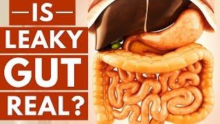 Is Leaky Gut Syndrome a Real Thing?