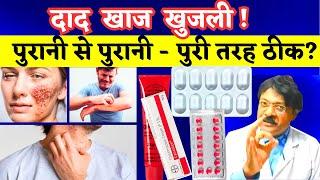 Dad Khaj Khujli Ki Dawa | दाद खाज खुजली को जड़ से कैसे ठीक करें | 3 Best Medicine For Dad Khaj Khujli