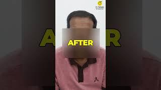 HT Results Before vs After  | Unbelievable Transformation! 