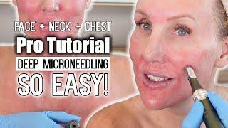 Deep Microneedling on Face + Neck + Chest  PRO TUTORIAL #microneedling #antiagingskincare