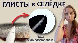 Множество паразитов в солёной селёдке.  Как такое есть ??