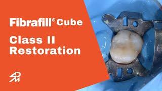 Fibrafill Cube Class II Restoration