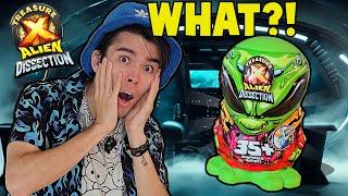 THE TREASURE X MEGA ALIEN DISSECTION *ULTIMATE UNBOXING*