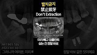 Don't Extraction