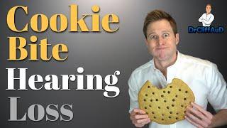 Cookie Bite Hearing Loss | The Hearing Loss of Dr. Cliff AuD