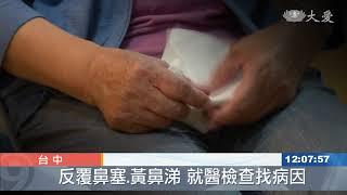 鼻竇炎復發頭痛難耐 3D微創手術治癒