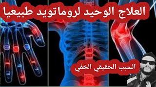 علاج التهاب المفاصل الروماتويدي طبيعيا ، مع شرح أعراض الروماتويد وماهي الاسباب الخفية لهذا المرض ؟