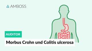 Morbus Crohn und Colitis ulcerosa - Worin unterscheiden sie sich? - AMBOSS Auditor