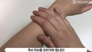 혈전 위험신호