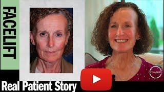 Facelift Surgery And Recovery - What to expect during and after your surgery...