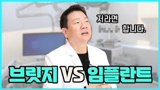 치과치료, 임플란트 vs 브릿지, 광진예치과 강남현 원장