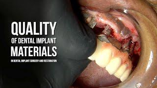 Quality of  Dental Implant Materials in Dental Implant Surgery and Restoration