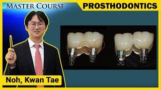 [Master Course Season2 -PROSTHODONTICS] Crown - Related Complications