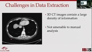 Stanford Radiology: PHIND (Summer) 2022, Chaudhari: Disease Prediction using Imaging & Deep Learning