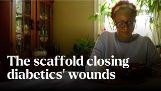 The scaffold closing diabetics’ wounds  - Nature's Building Blocks | BBC StoryWorks