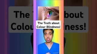 The TRUTH about Color Blindness - Doctor Explains!