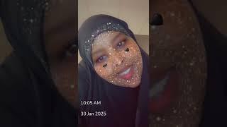 Xanuun saaid baan dareemayaa maanta