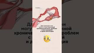 ‍️ Спайки. Способы лечения