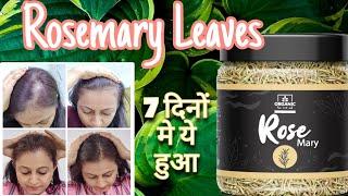 7 दिन रोज़मेरी पत्तों का इस्तेमाल किया और ये हुआ | Rosemary - Honest Review After Using for 7 Days