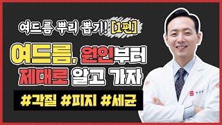 여드름이 발생하는 원인│나의 '이 것'이 문제 타이밍도 중요하다는 사실! 