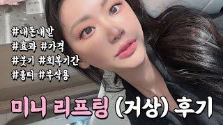 vlog  미니리프팅(미니거상) 내돈내산 시술 후기 브이로그. (효과, 가격, 붓기, 회복기간, 흉터, 부작용, 전후 다 알려줌)