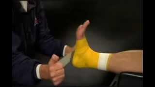 Ankle and lower leg post injury taping