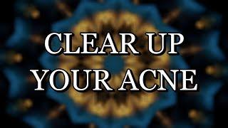 285 Hz – CLEAR UP YOUR ACNE - GET PERFECT SKIN – Meditation Music (With Subliminal Affirmations)