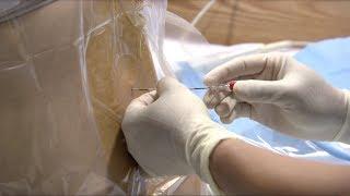 Epidural injection procedure