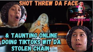 Houston Female Rapper SkyTheFinest) Shot Threw da Face) In The Hospital Taunting With Da Opps Chain