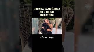 Как Оксана Самойлова изменилась после пластики #shorts