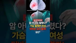 멀쩡한 가슴 잘린 참사… 암도 없는데 수술 [의료사고]